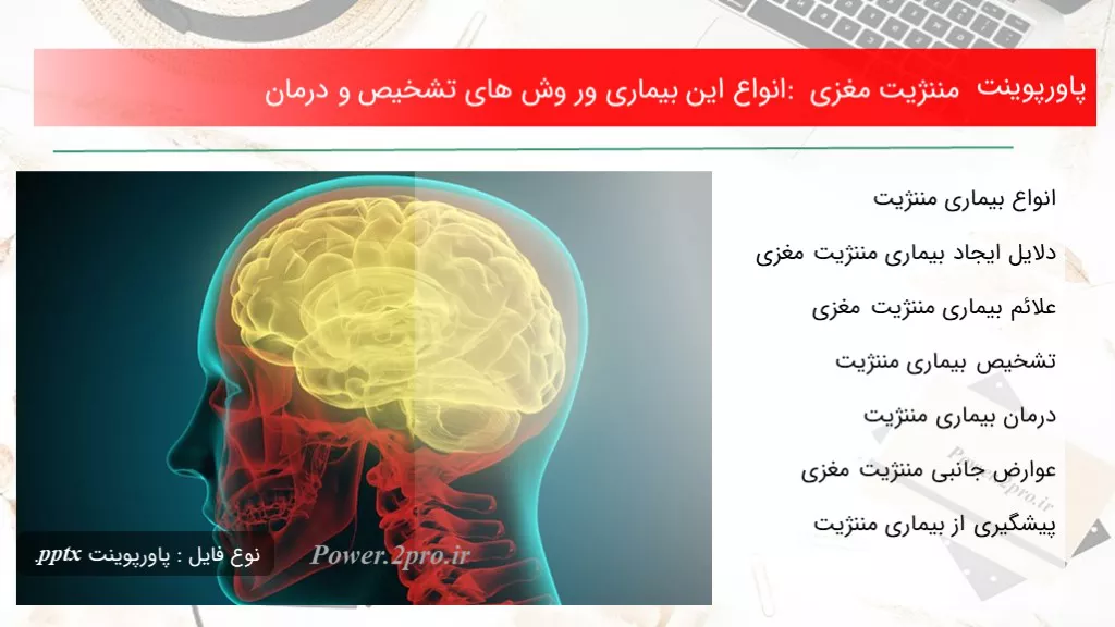 دانلود پاورپوینت مننژیت مغزی : انواع این بیماری ور وش های تشخیص و درمان - کد119321