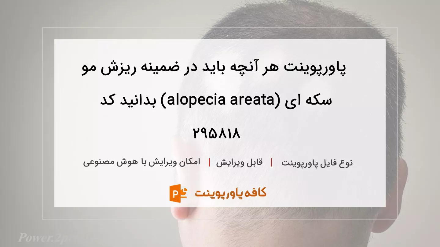 دانلود پاورپوینت هر آنچه باید در ضمینه ریزش مو سکه ای (alopecia areata) بدانید کد 295818