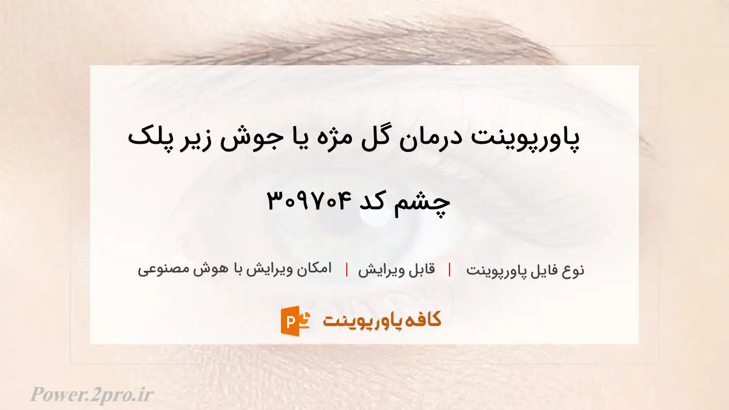 دانلود پاورپوینت درمان گل مژه یا جوش زیر پلک چشم کد 309704