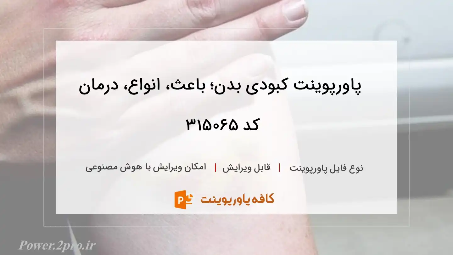 دانلود پاورپوینت کبودی بدن؛ باعث، انواع، درمان کد 315065